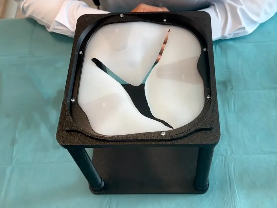 Our mitral valve simulator in its black printed frame